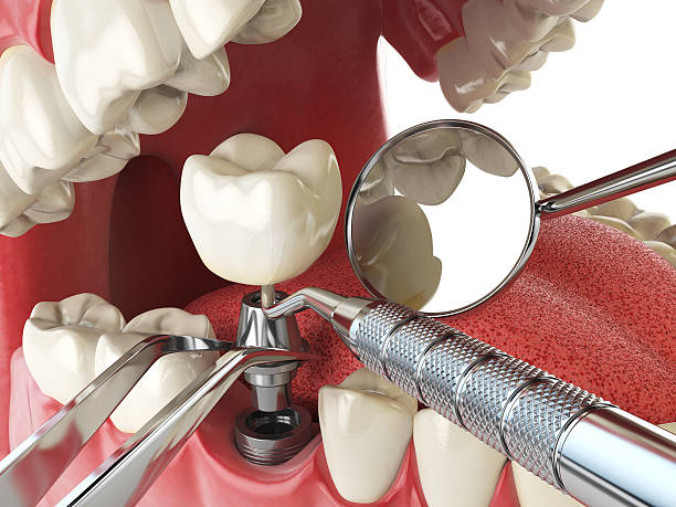 Best Cosmetic Emergency Dentistry in Bay Park, NY